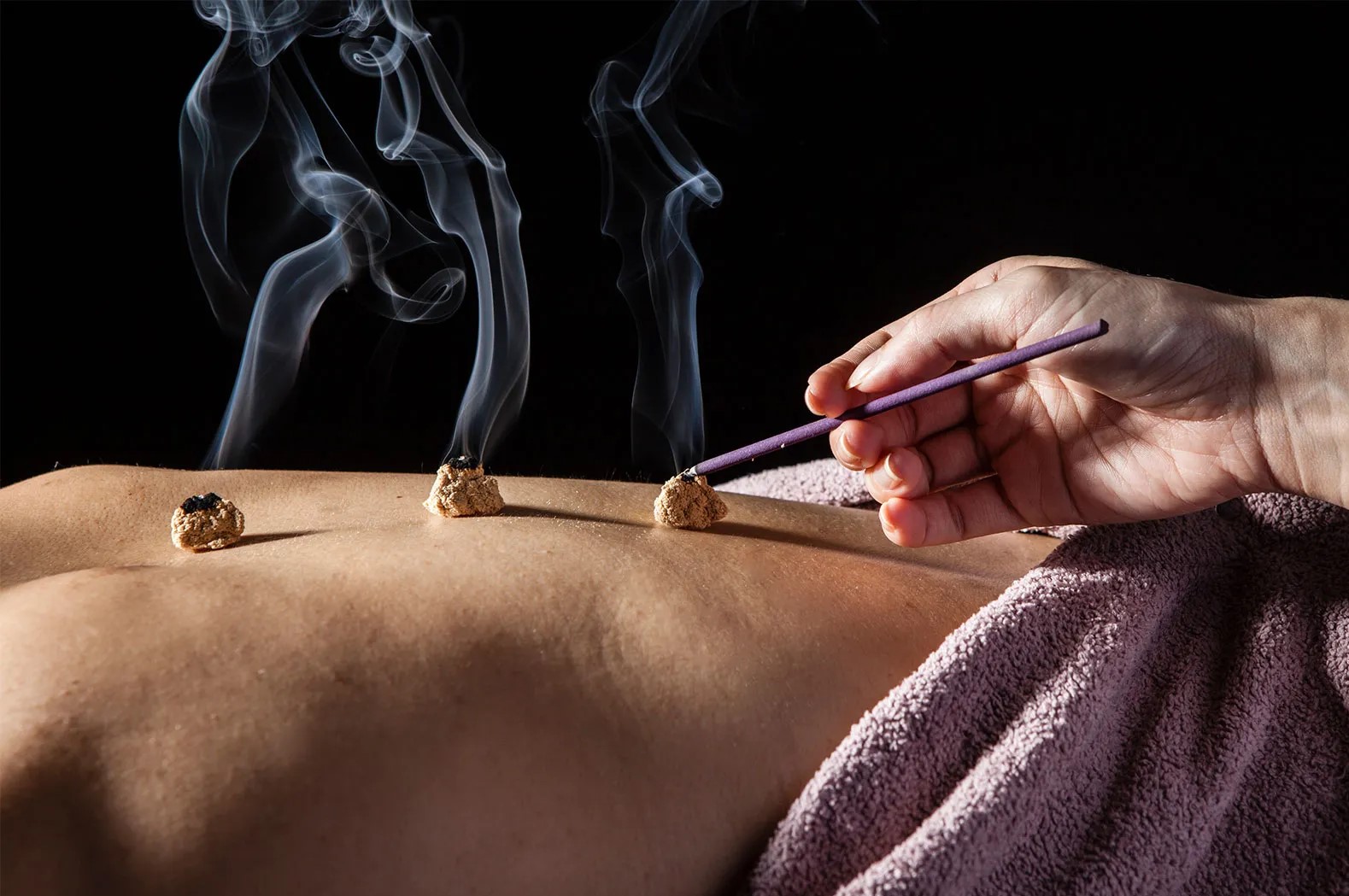 moxibustion-cones-moxa-